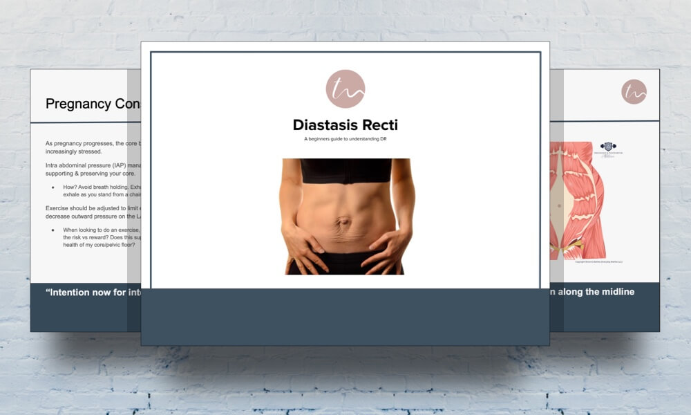 Diastasis Recti eBook